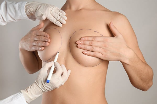 augmentation mammaire par lipofilling graisse paris augmentation mammaire seins chirurgie des seins mammaire paris chirurgien esthetique plasticien paris docteur montoneri