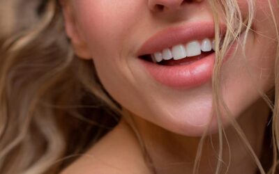 Lifting de la lèvre supérieure (ou lip lift) : quelles cicatrices ?
