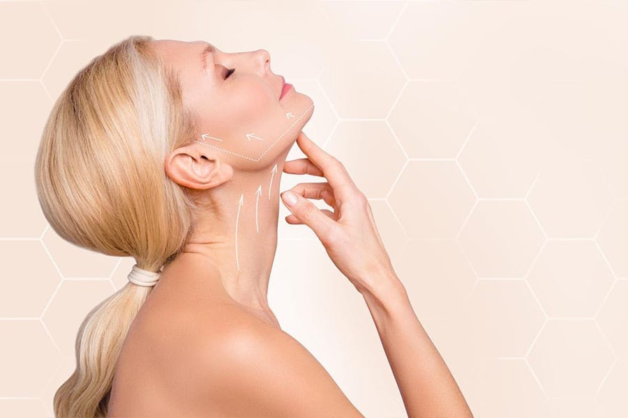 resultats lifting visage 2 mois apres intervention chirurgie et medecine esthetique dr sebastiano montoneri chirurgien esthetique paris