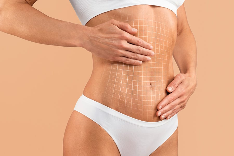 meilleur chirurgien abdominoplastie paris dr sebastiano montoneri chirurgien esthetique paris